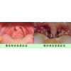 宝鸡慢性咽炎|陕西高水平的慢性咽炎治疗