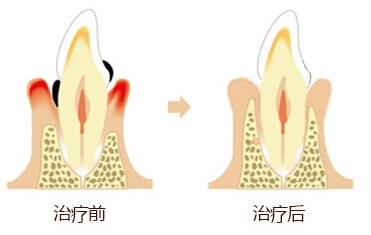 基础牙科服务